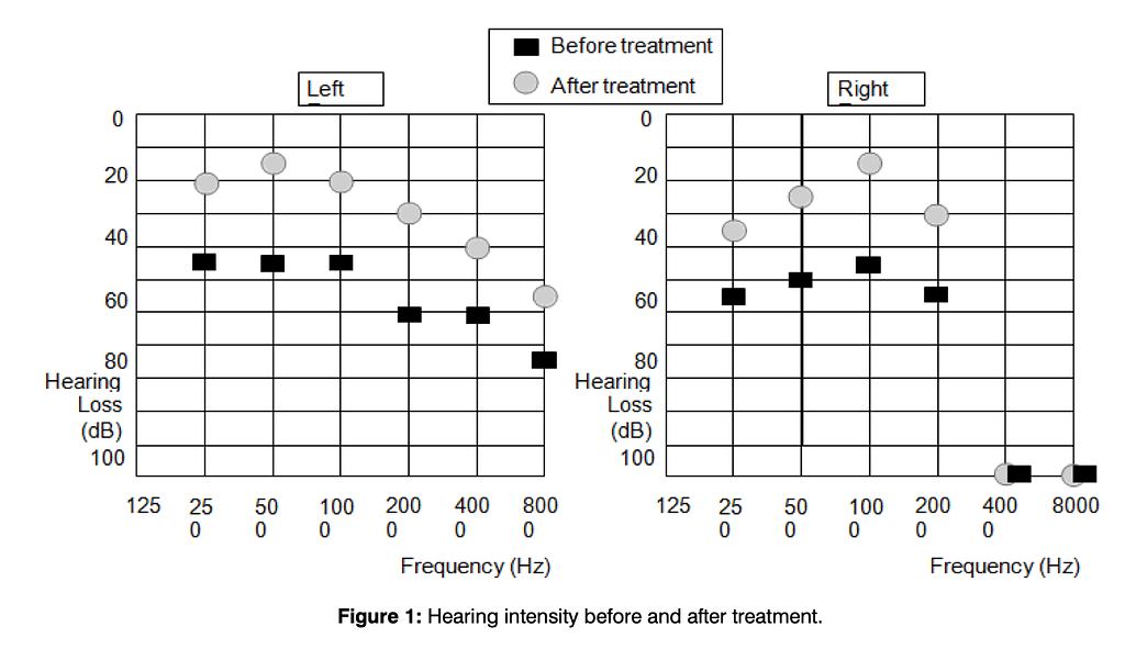 radiofrequenza del nervo vago